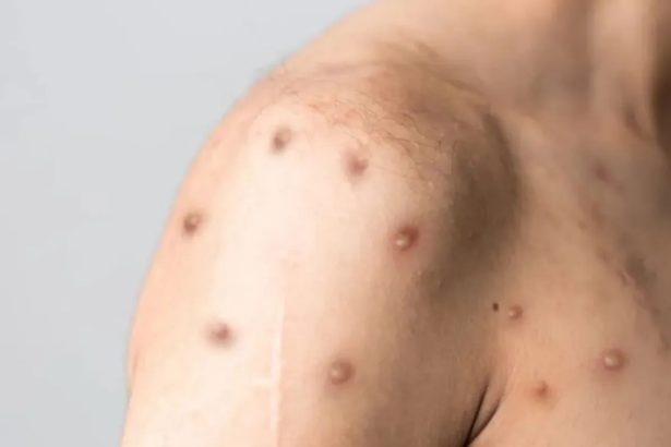 Créditos: Imagem/Divulgação