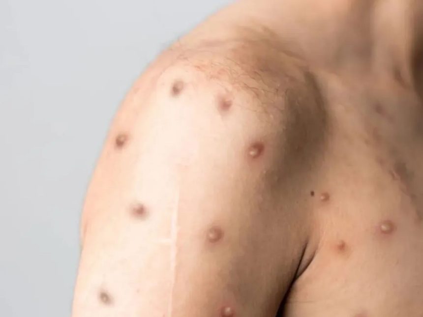 Créditos: Imagem/Divulgação