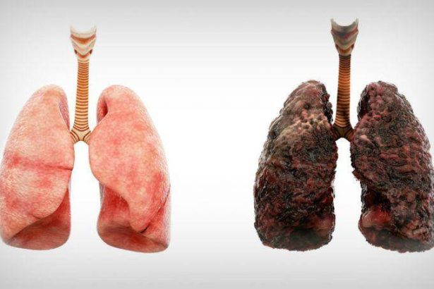 Créditos: Imagem/Divulgação