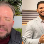 Apresentador famoso aplica botox e exibe complicações após procedimento